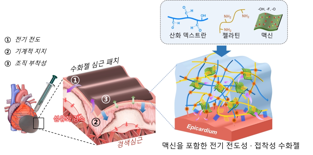 심장에 발라서 심근경색 치료” 지스트-전남대병원, 수화젤 심근패치 개발 (ACS Nano, 2023.6.)